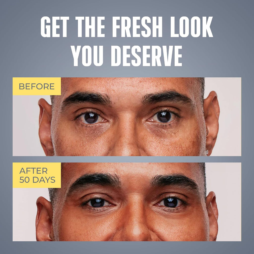 Men's Eye Cream - Under Eye Treatment for Men