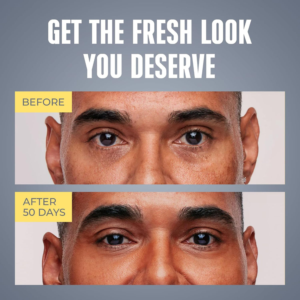 Men's Eye Cream - Under Eye Treatment for Men